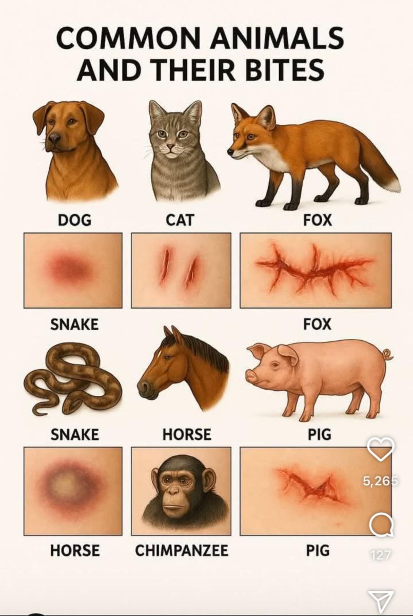 A panel of various animals and the bite marks they leave on human skin